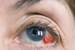 Hôn mê, vỡ mạch máu võng mạc sau chuỗi ngày thức đêm ăn vặt