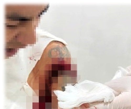 Anh X. bị chém trọng thương. Ảnh: T. Vinh