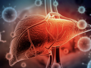 Nguy cơ ung thư từ 'sát thủ thầm lặng' gan nhiễm mỡ