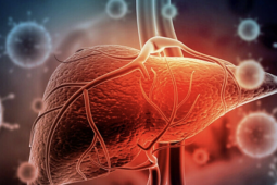 Nguy cơ ung thư từ 'sát thủ thầm lặng' gan nhiễm mỡ