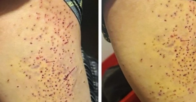 Tranh chấp chỗ ngồi, nữ sinh lớp 7 dùng bút bi đâm nhiều lần vào đùi bạn học