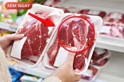 Tin tức sức khỏe - 5 loại thực phẩm cực hại cho tuyến tiền liệt của phái mạnh, nhiều người vẫn vô tư ăn mỗi ngày