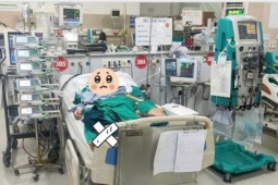 Nữ sinh 17 tuổi nguy kịch vì bệnh hiếm, y văn mới ghi nhận hơn 600 trường hợp