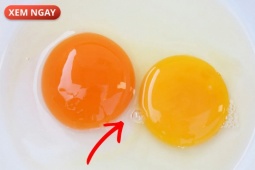 Tin tức sức khỏe - 4 món ăn quen thuộc có thể làm phì đại tuyến tiền liệt nặng hơn - Nam giới cần xem ngay!