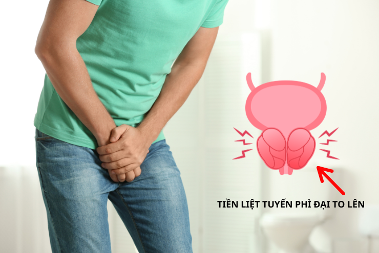 4 món ăn quen thuộc có thể làm phì đại tuyến tiền liệt nặng hơn - Nam giới cần xem ngay! - 3