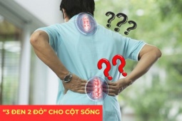 Tin tức sức khỏe - "3 đen 2 đỏ" giúp cột sống dẻo dai - bí kíp “chuẩn không cần chỉnh” được người xưa truyền lại
