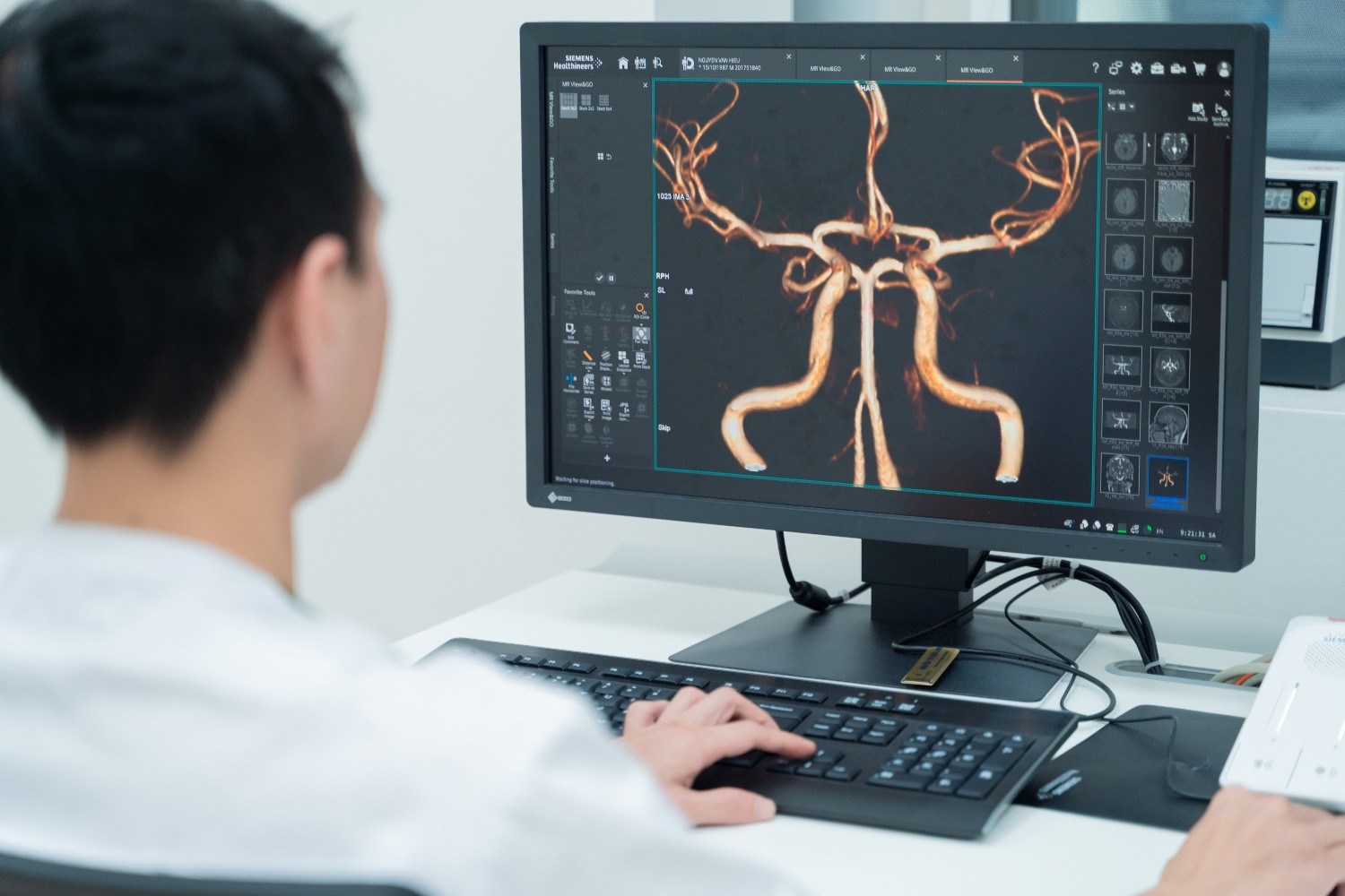 &nbsp;Hình ảnh độ phân giải cao hỗ trợ bác sĩ phát hiện sớm các tổn thương vi thể.