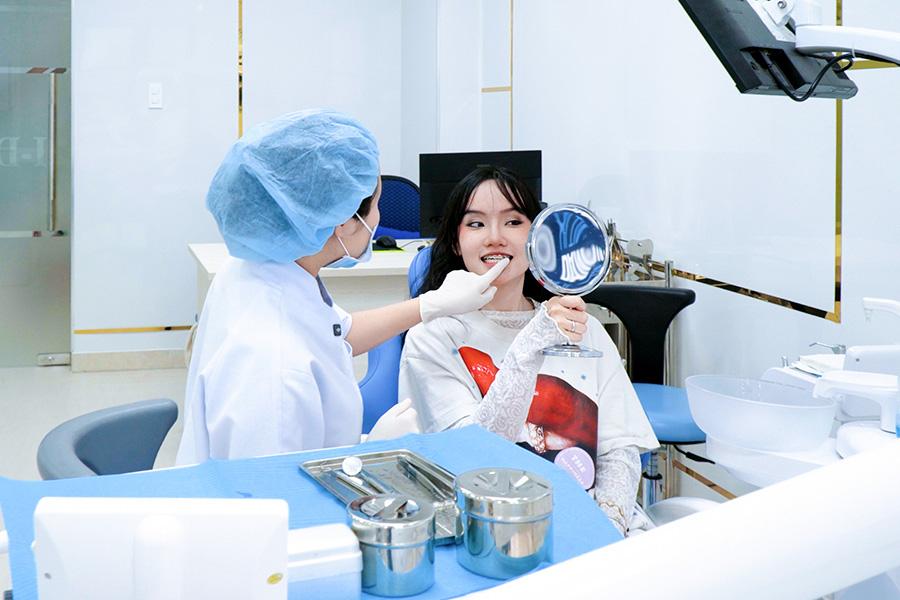 Niềng răng mắc cài kim loại được nhiều người lựa chọn bởi có chi phí hợp lý.