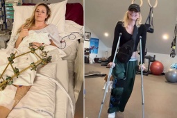 Nóng nhất thể thao tối 19/3: Nữ hoàng trượt tuyết không giải nghệ dù suýt mất chân