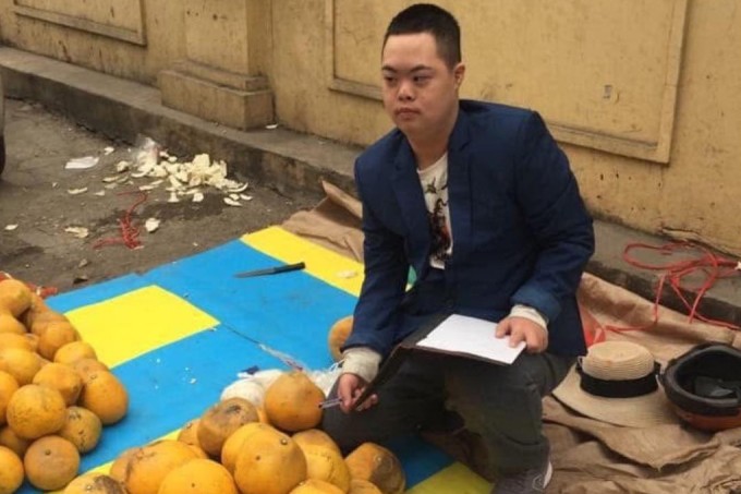 Nhiều người dừng lại mua hàng, ủng hộ khi biết hoàn cảnh của Bảo Sơn. Ảnh: NVCC