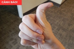 Tin tức sức khỏe - 5 thói quen tàn phá xương khớp cực nhanh: Nên bỏ càng sớm càng tốt!