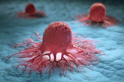 Tin tức sức khỏe - 3 nguyên tắc vàng ngăn sự hình thành khối u