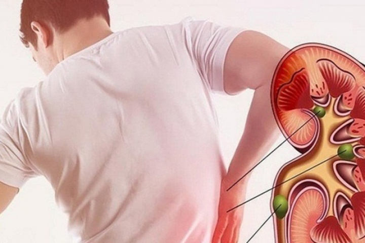 5 dấu hiệu cho thấy thận của nam giới khỏe mạnh: Bạn có bao nhiêu?