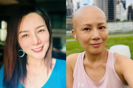 Á hậu Hong Kong suy sụp vì ung thư