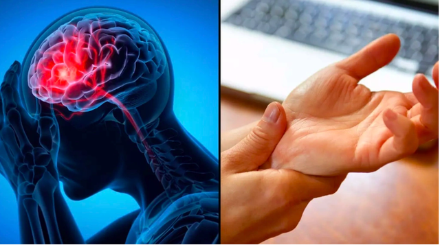 Nhiều người lầm tưởng khi tay chân tê bì, mất cảm giác mới là lúc cơn đột quỵ cận kề. Ảnh minh họa