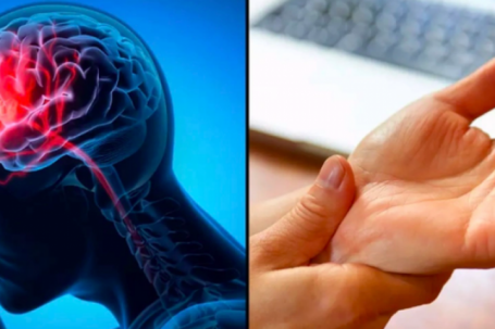 Dấu hiệu nguy hiểm nhất của đột quỵ không phải tê tay chân, nhiều người vẫn đang hiểu lầm