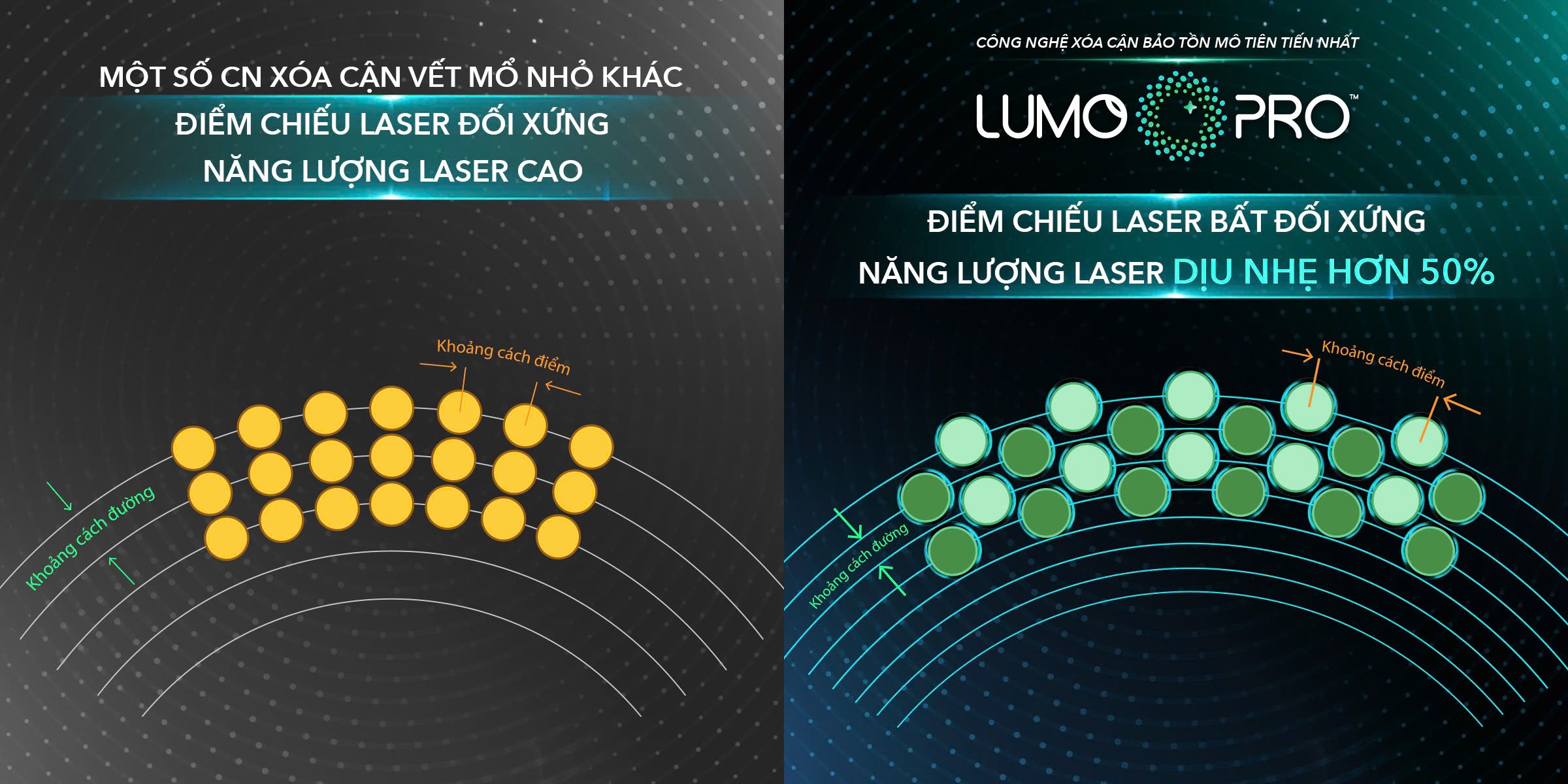 Áp dụng điểm chiếu laser bất đối xứng, năng lượng laser của công nghệ xóa cận LUMOPRO™ dịu nhẹ hơn 50% so với một số công nghệ xóa cận vết mổ nhỏ khác.