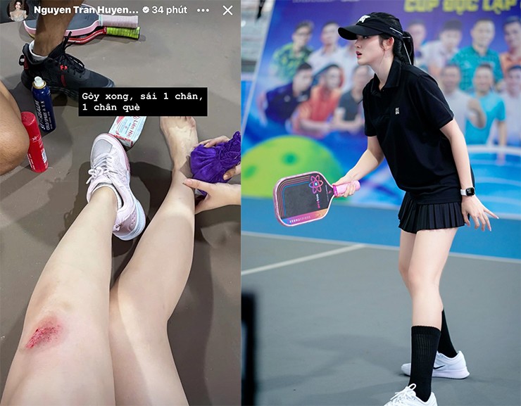 Á hậu Huyền My bị trầy xước, lật cổ chân khi chơi pickleball
