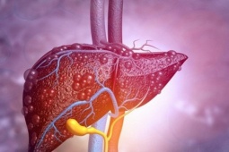 4 giải pháp trị gan nhiễm mỡ không dùng thuốc