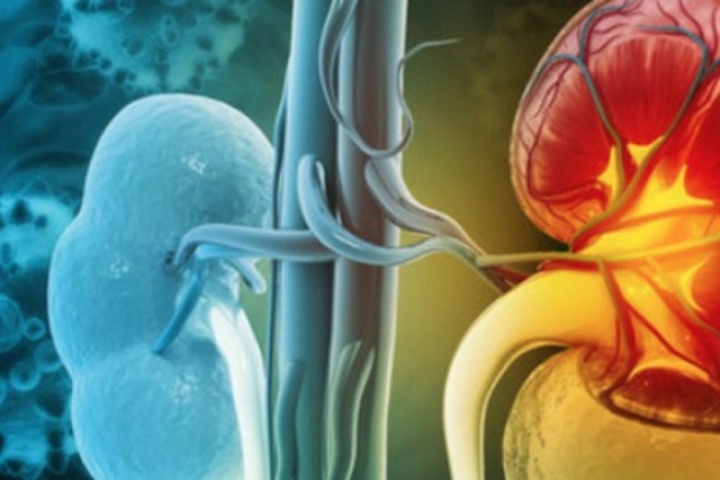 Thói quen ăn uống tăng nguy cơ suy thận, nhiều người Việt đang mắc phải mà không biết