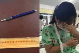 Thực hư vụ việc cô giáo ở Huế "đánh gãy tay" học sinh lớp 4