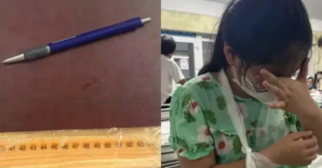 Thực hư vụ việc cô giáo ở Huế "đánh gãy tay" học sinh lớp 4