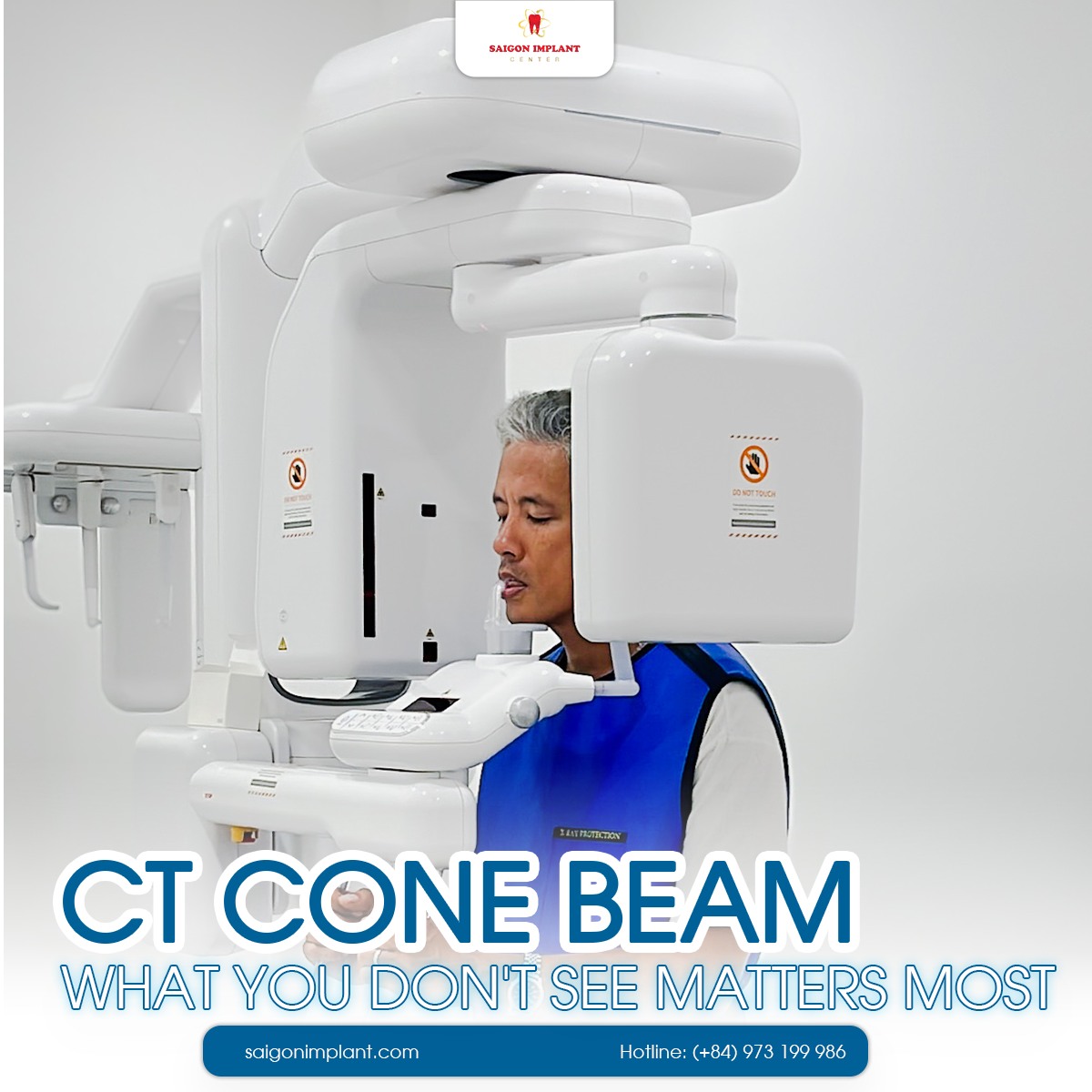 Nha khoa Sài Gòn Implant giải mã quy trình sau một ca cấy ghép Implant - 1