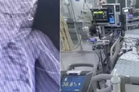 Bé gái mới biết đi bị ngã vào thùng nước khiến ngưng tim ngưng thở