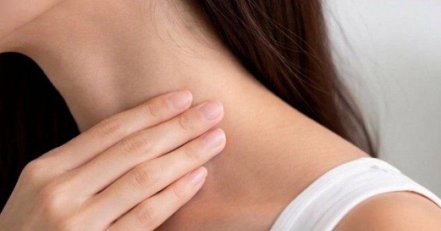 Đi khám u cổ, cô gái sốc phát hiện mắc ung thư dạ dày di căn