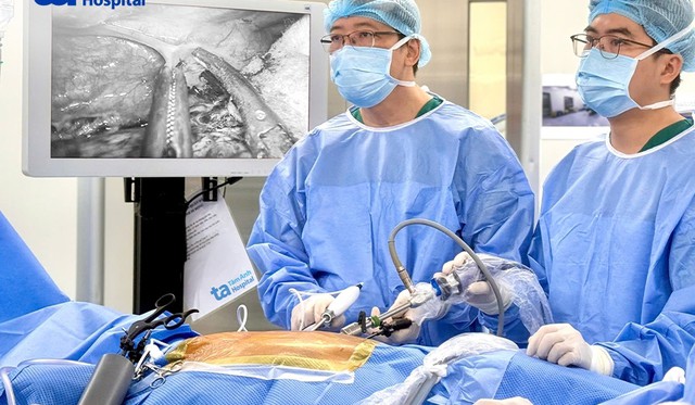 Các bác sĩ đang thực hiện phẫu thuật nội soi cắt thực quản cho người bệnh. Ảnh: BVCC