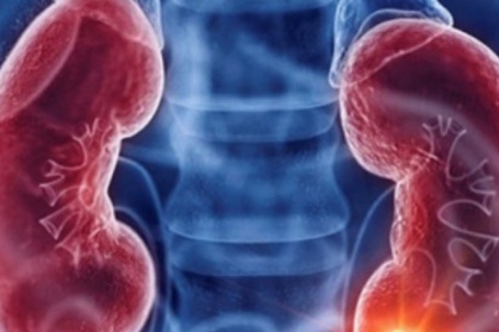 Người đàn ông bất ngờ phát hiện mắc ung thư thận từ dấu hiệu nhiều người Việt bỏ qua