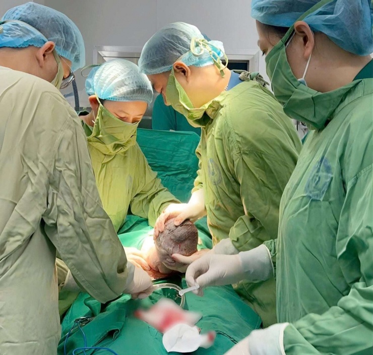 Khoảnh khắc chào đời đặc biệt của em bé tại Bệnh viện Phụ sản Trung ương. Ảnh: BVCC