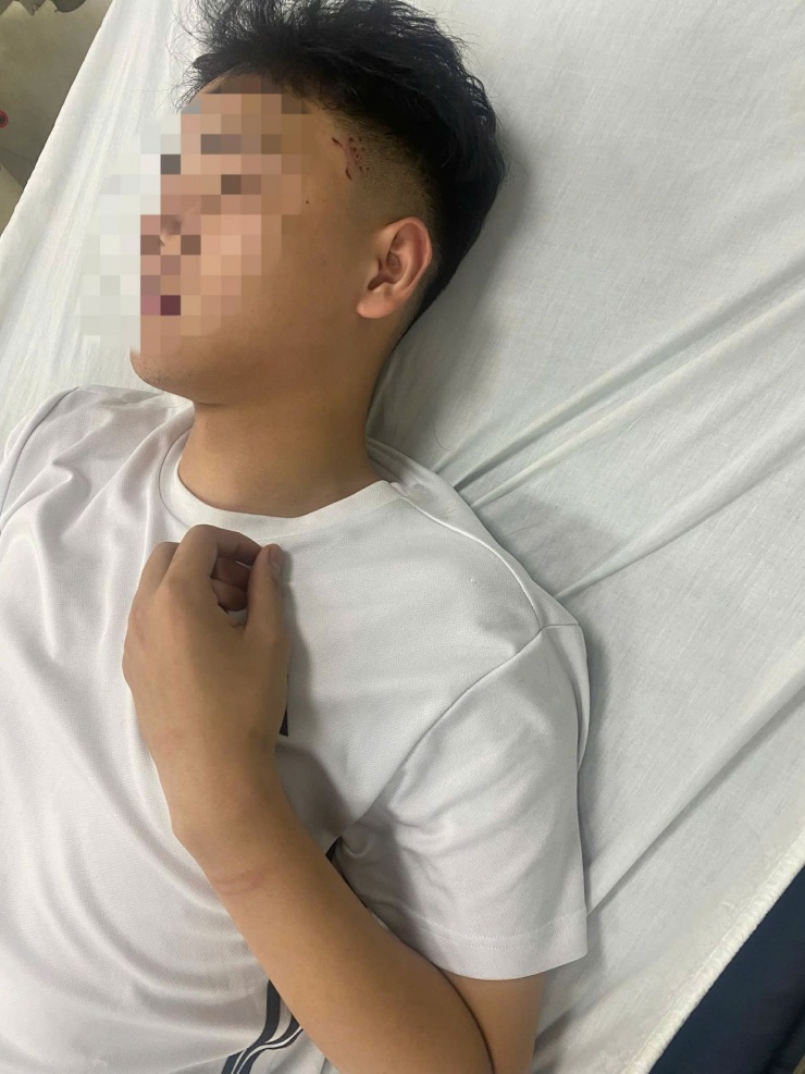 Nam sinh bị đánh.