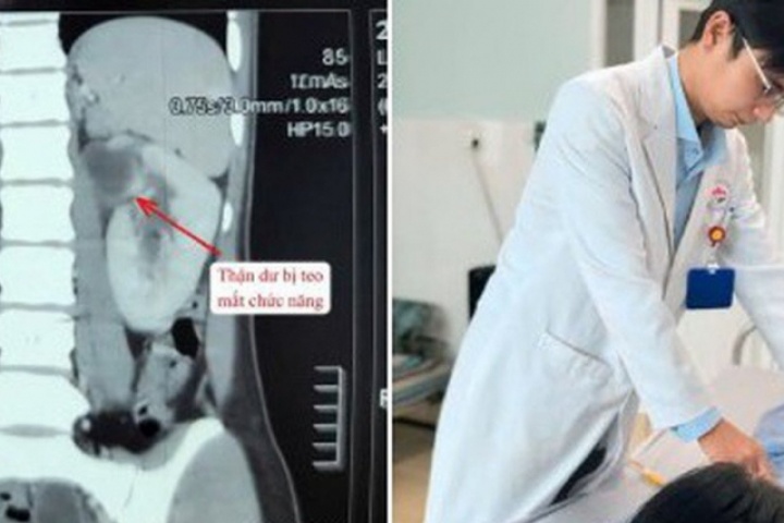 Cô gái 22 tuổi mất chức năng thận vì dị tật hiếm, bác sĩ cảnh báo dấu hiệu dễ bỏ qua