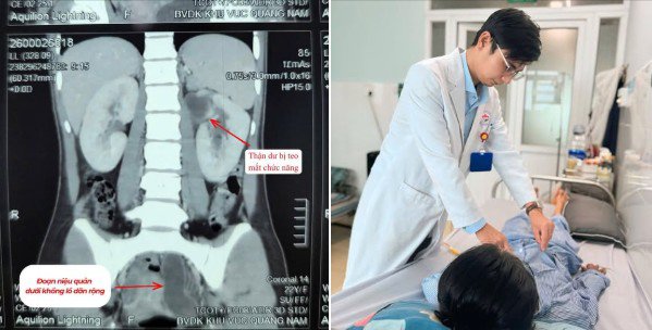 Hình ảnh thận trên phim. Ảnh: BVCC.