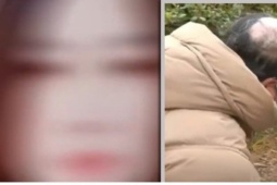 Vợ xấu xí, rụng tóc do bệnh, chồng đòi ly hôn vì sợ mất mặt