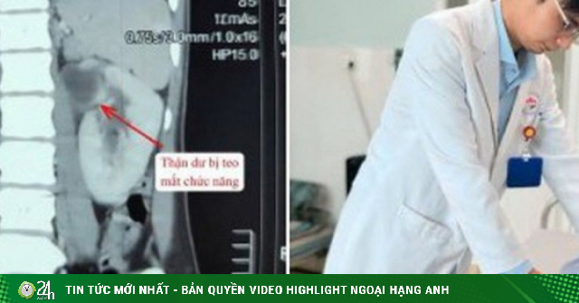 Cô gái 22 tuổi mất chức năng thận vì dị tật hiếm, bác sĩ cảnh báo dấu hiệu dễ bỏ qua
