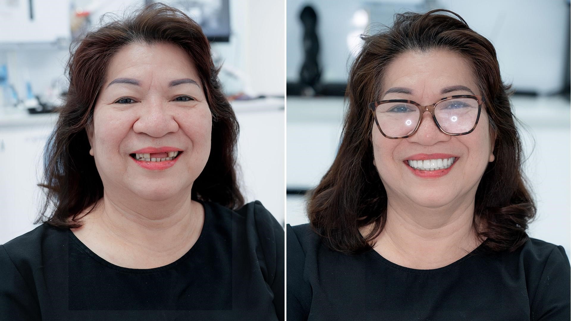 Nha khoa SGC - Khẳng định vị thế Nha khoa trồng răng chất lượng tại TPHCM - 2