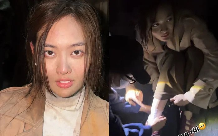 Thùy Anh gặp chấn thương phải băng bó tại phim trường.