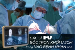 Bác sĩ FV bóc trọn khối u 2cm trong não bệnh nhân nhờ công nghệ định vị Navigation thế hệ mới