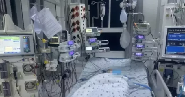 Cảnh báo: Virus mới khiến trẻ mắc tay chân miệng chuyển nặng, tử vong rất nhanh