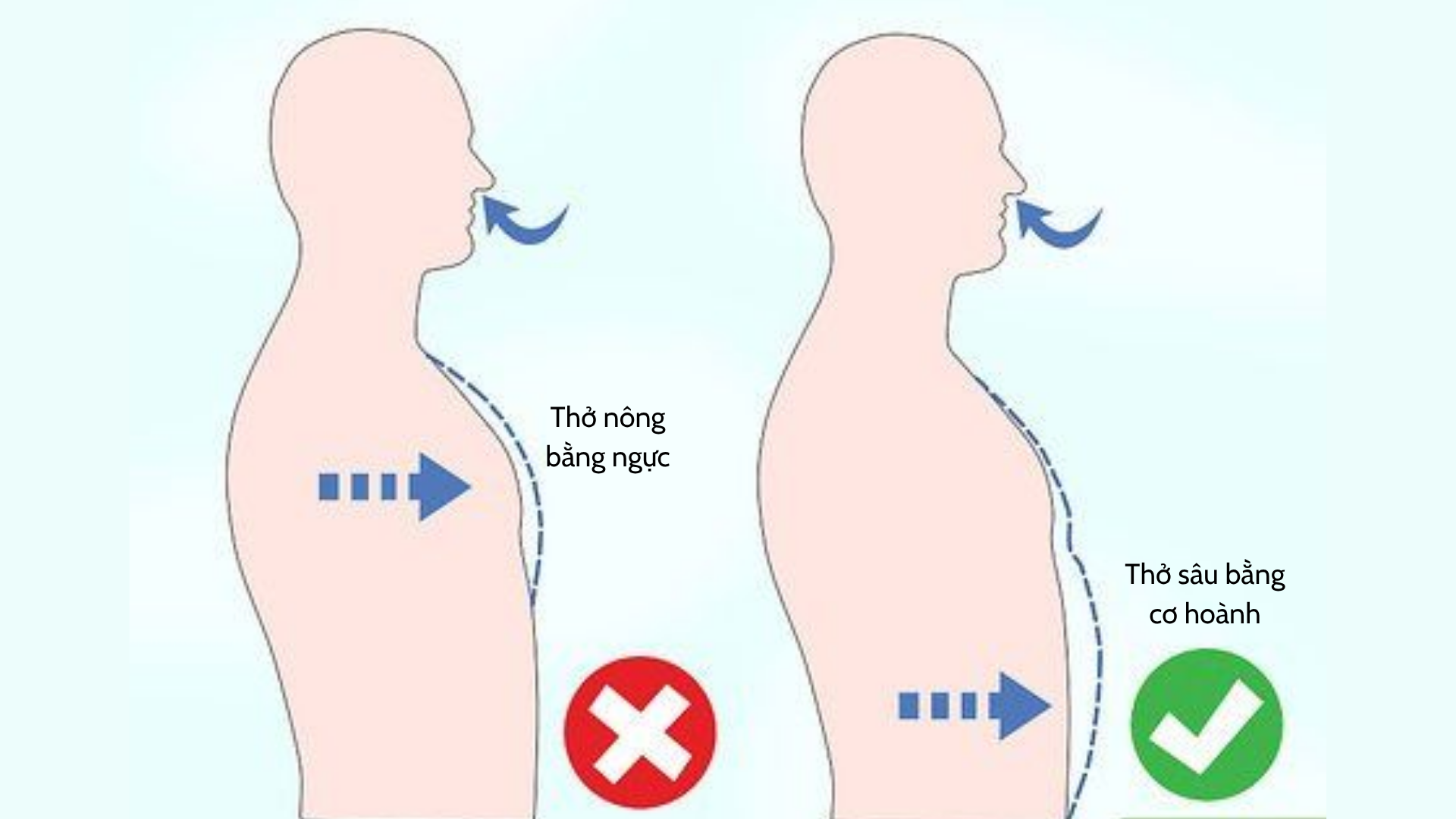 Sai lầm khiến phổi yếu dần, đàm tích tụ mỗi ngày: Nhiều người vẫn đang mắc phải! - 2