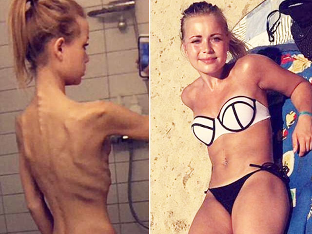 Bí quyết làm đẹp - "Bộ xương khô" khỏe đẹp bất ngờ nhờ múa cột