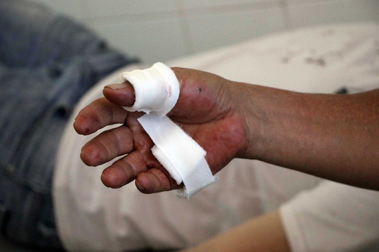 Nổ súng tại Đà Lạt, hai cha con trúng đạn - 2