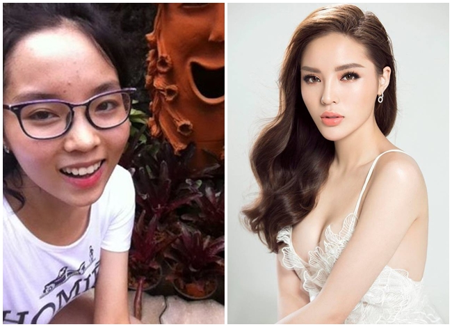 Hoa hậu Kỳ Duyên được nhận xét là &#34;dậy thì thành công&#34; nhất trong số các Hoa hậu Việt Nam. Thuở học sinh, cô nàng có làn da bánh mật cùng gương mặt lấm tấm mụn.