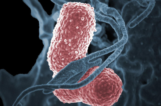 Vi khuẩn “ác mộng” giết chết 50% số người nhiễm bệnh - 1