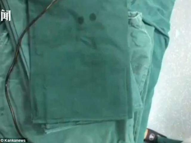 Phi thường - kỳ quặc - Dây sạc điện thoại 90cm kẹt trong “của quý” người đàn ông