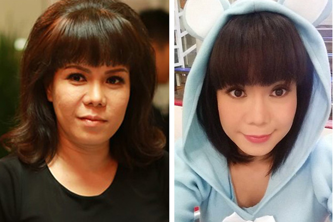 Xóa nhăn mắt: tưởng không dễ mà dễ không tưởng! - 4