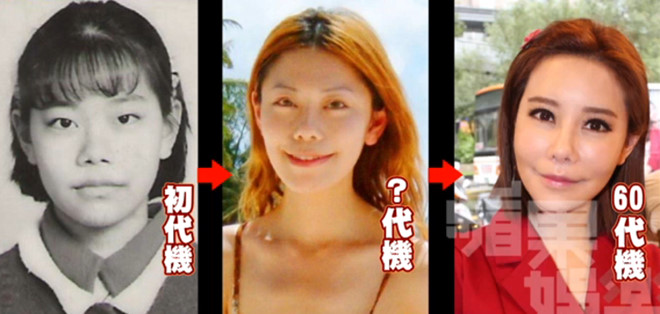 MC nóng bỏng bị biến chứng sau 60 lần "dao kéo" - 1