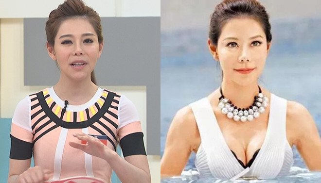 MC nóng bỏng bị biến chứng sau 60 lần "dao kéo" - 3